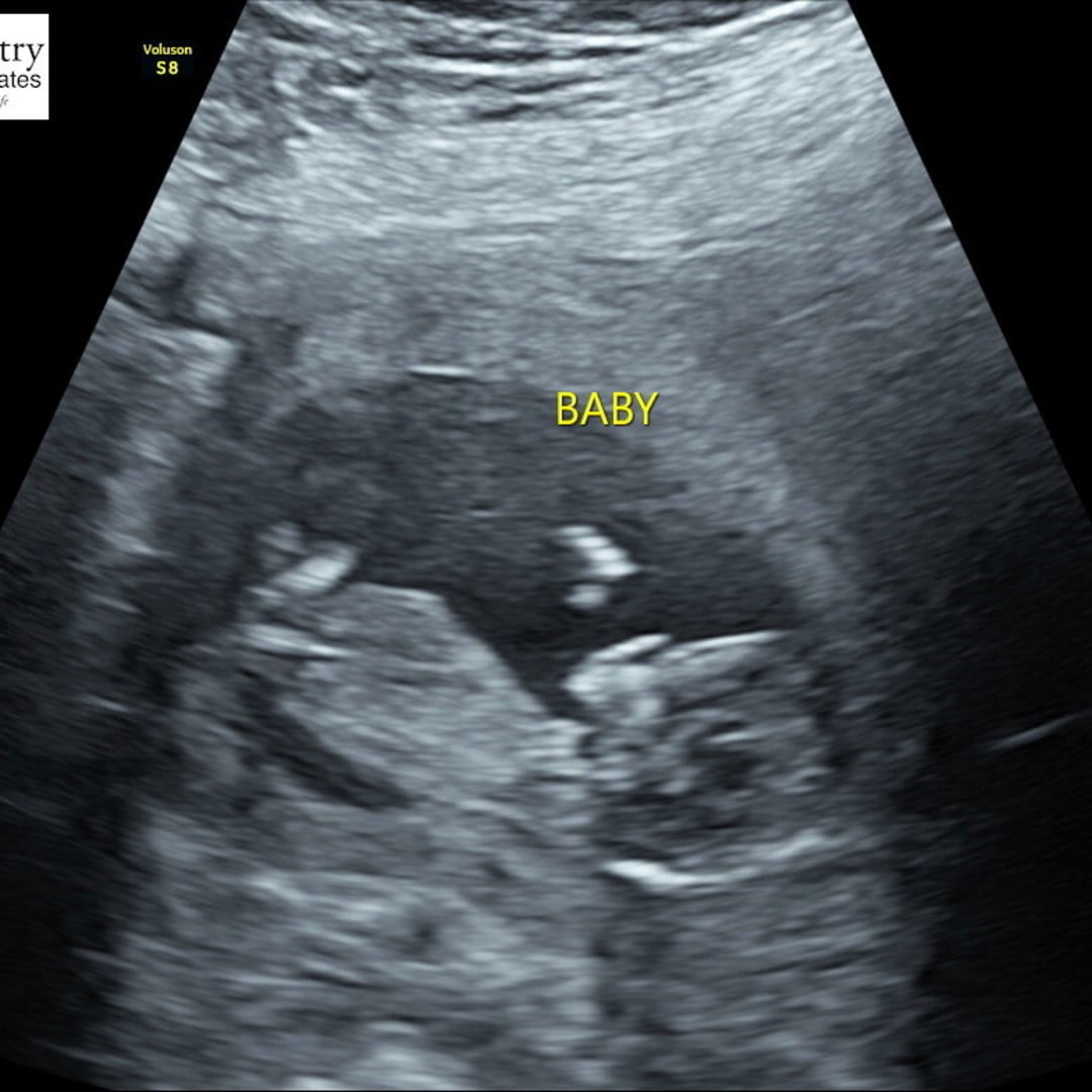 Photo shared by Kelsey for their Babylist baby registry.