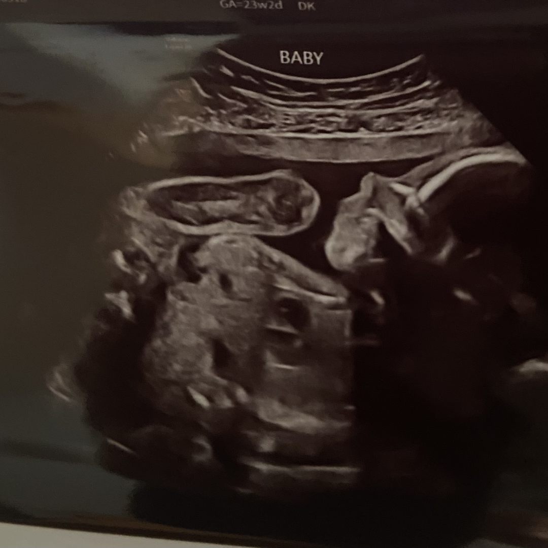 Photo shared by Ashley for their Babylist baby registry.