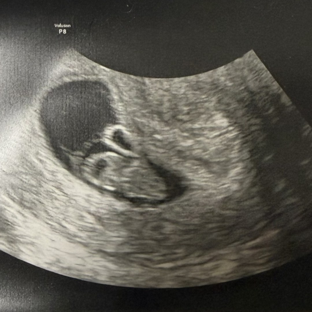 Photo shared by Glendale for their Babylist baby registry.