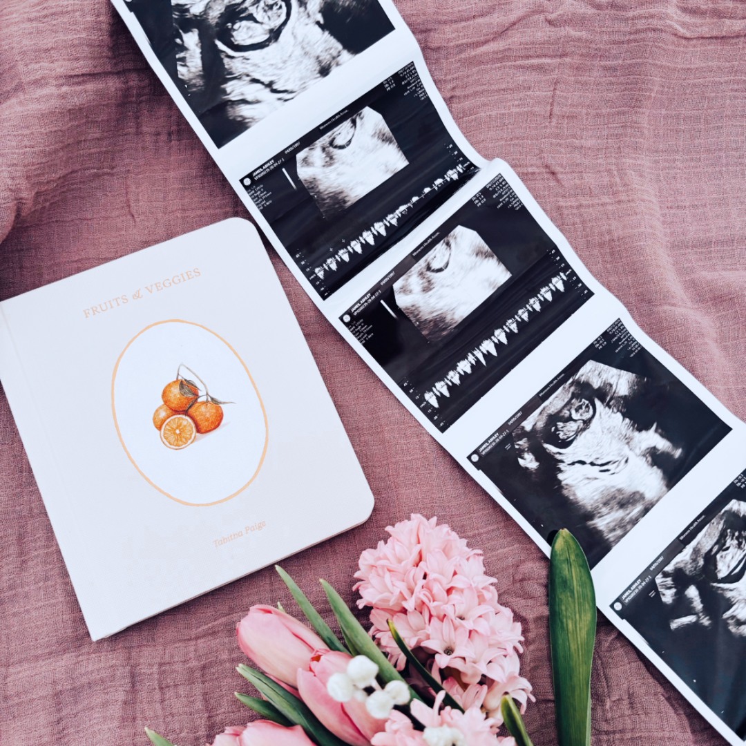 Photo shared by Ashley for their Babylist baby registry.