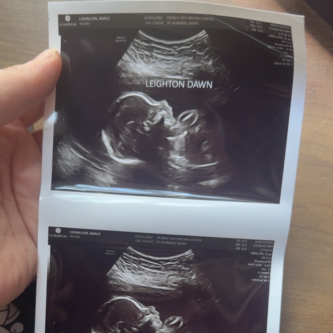 Photo shared by Adale for their Babylist baby registry.