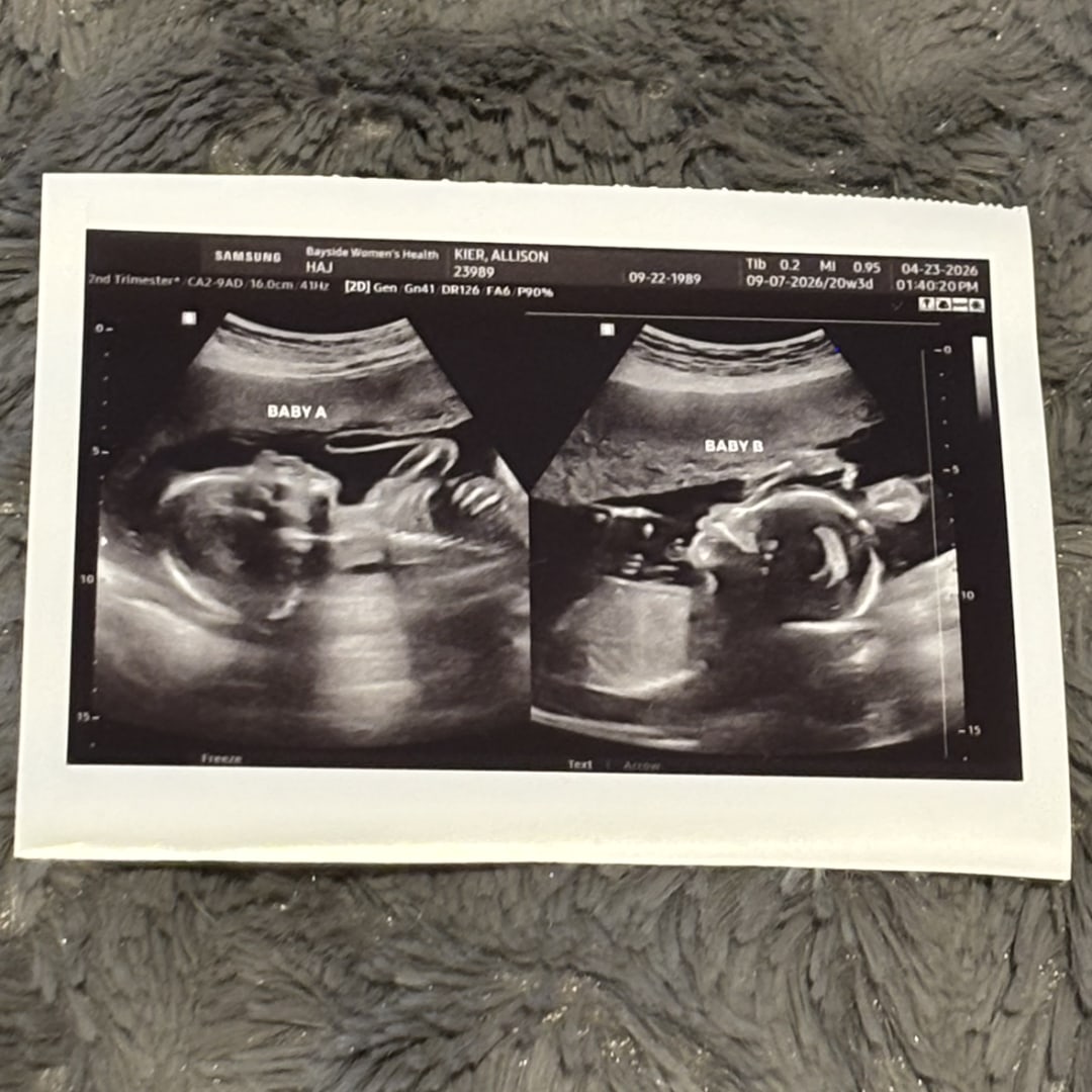 Photo shared by Allison for their Babylist baby registry.