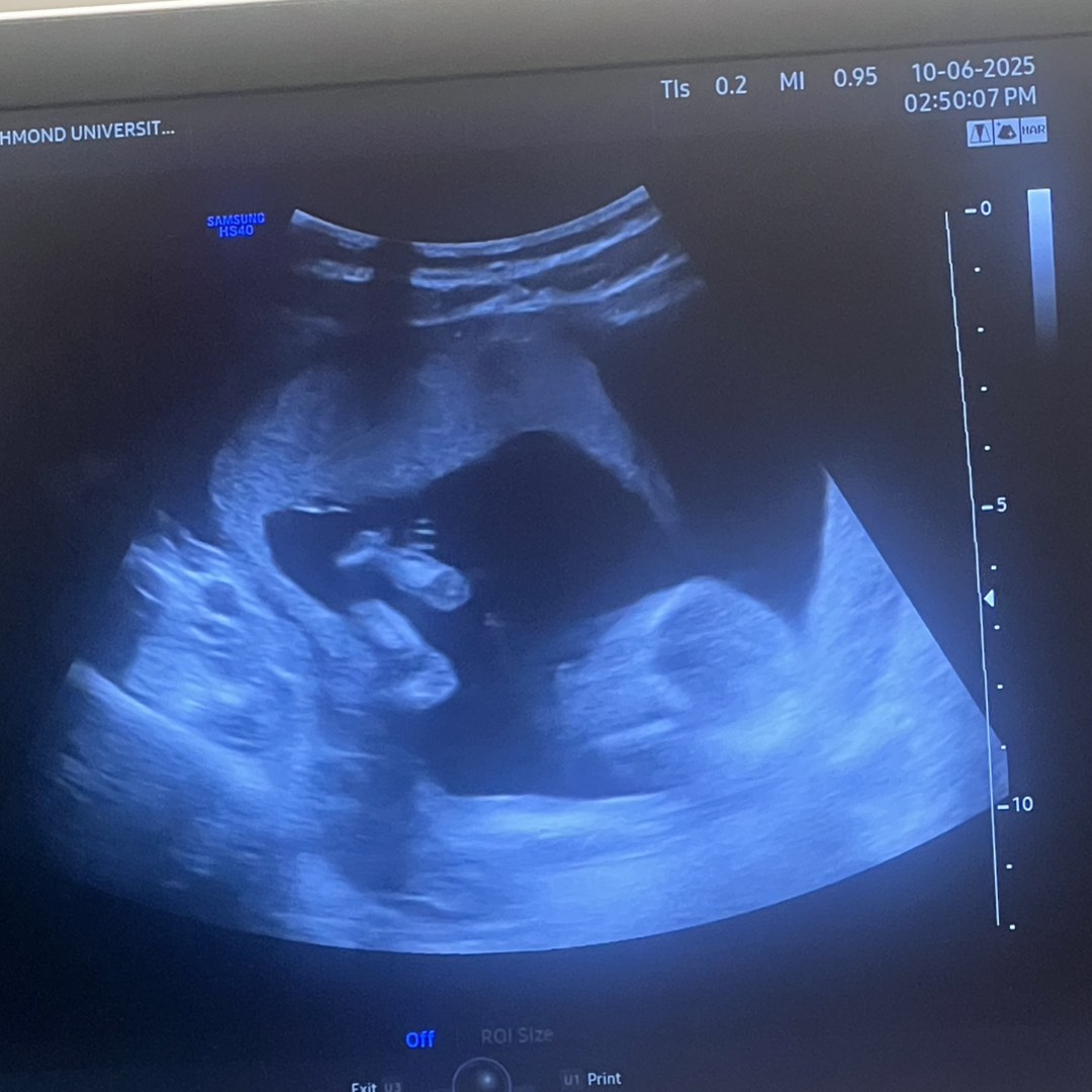 Photo shared by Shamecca for their Babylist baby registry.