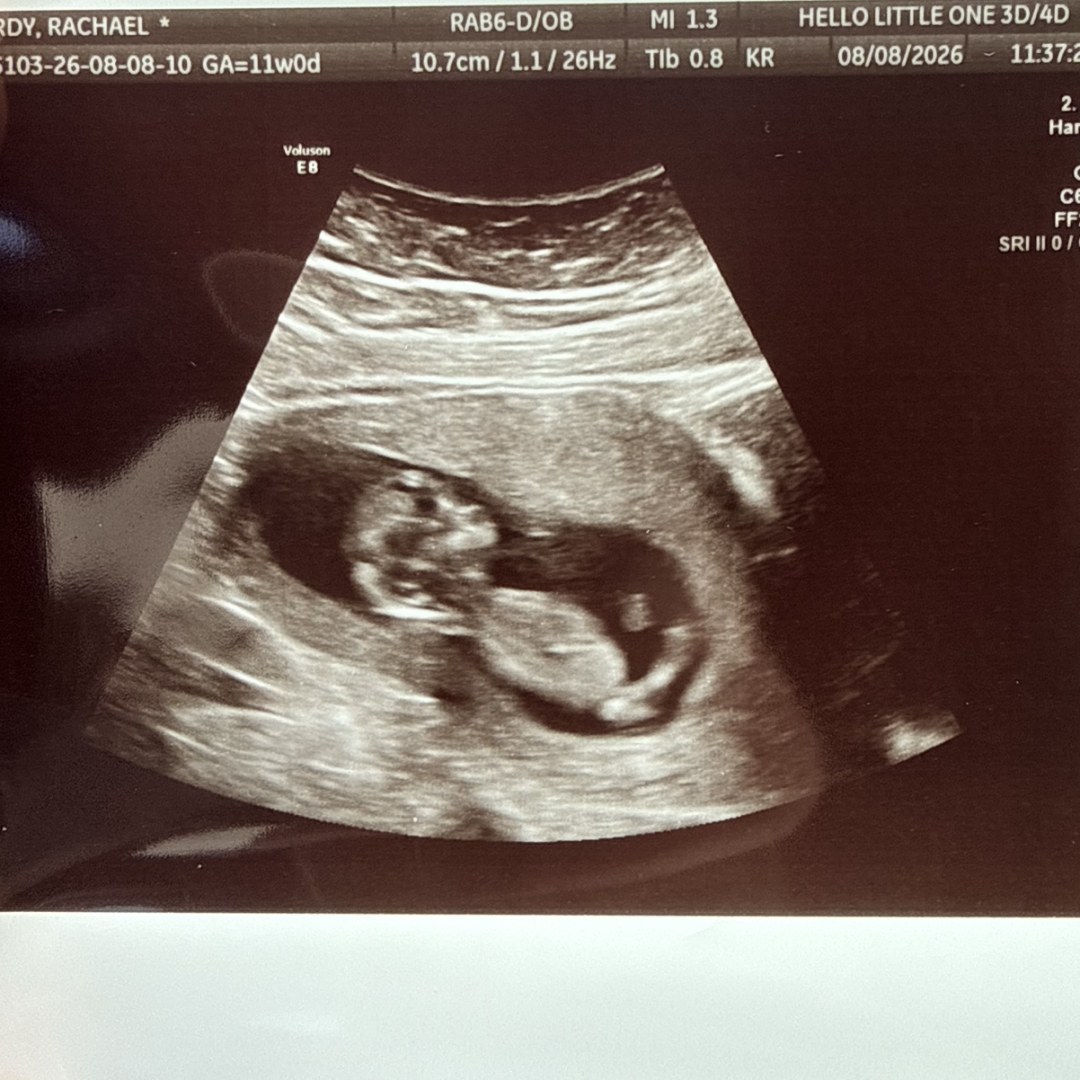 Photo shared by Rachael for their Babylist baby registry.