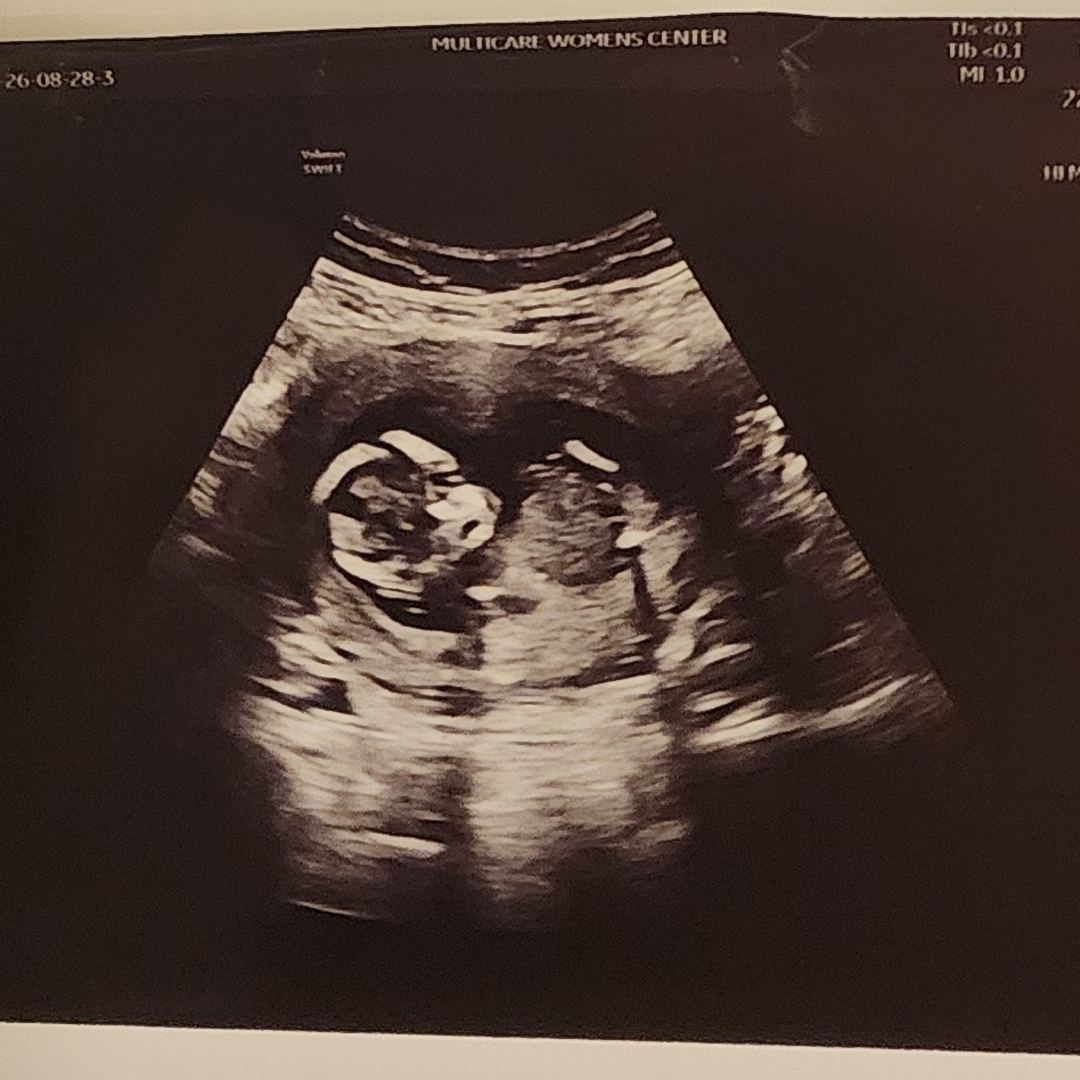 Photo shared by Breanna for their Babylist baby registry.