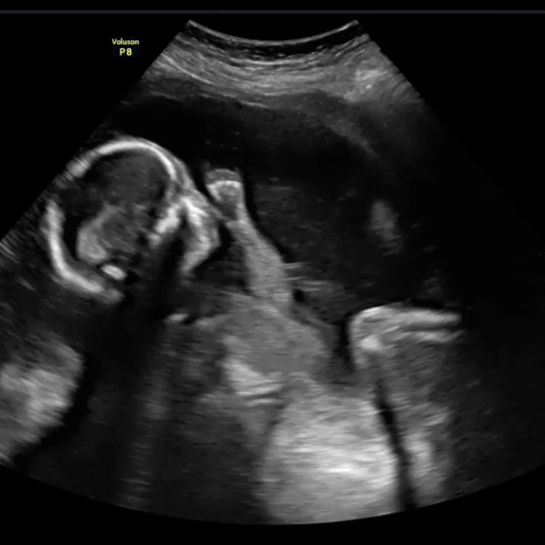 Photo shared by Mady for their Babylist baby registry.