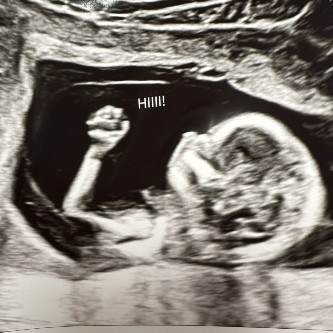 Photo shared by Emily for their Babylist baby registry.