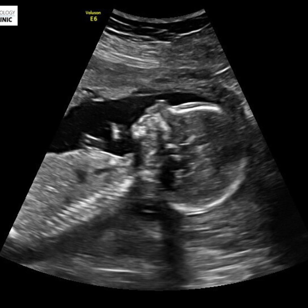 Photo shared by Kaitlyn for their Babylist baby registry.