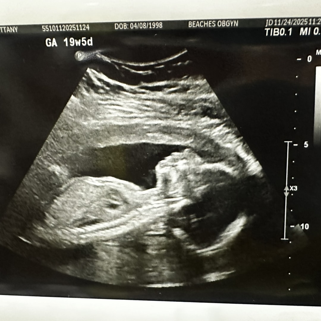 Photo shared by Brittany for their Babylist baby registry.