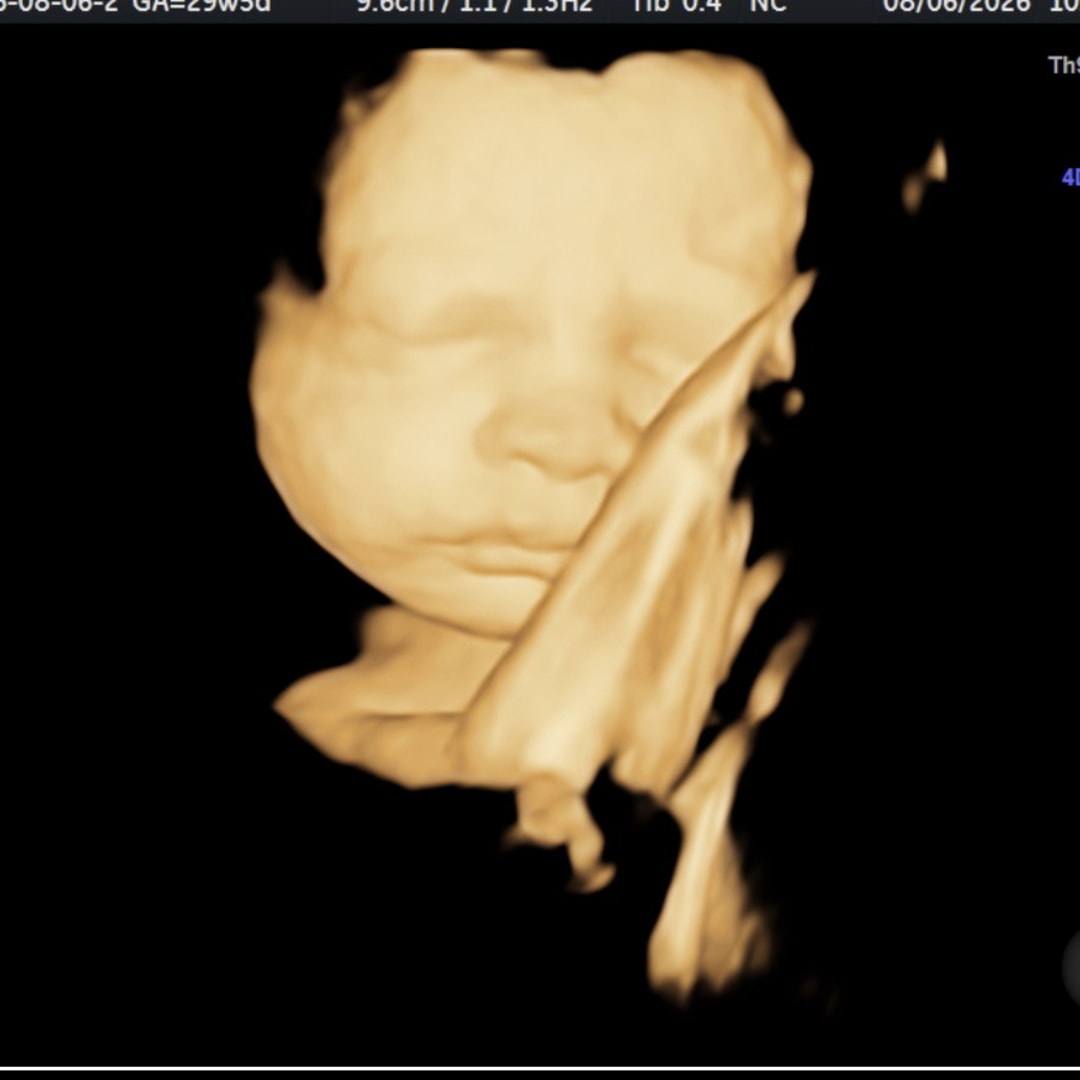 Photo shared by Marci for their Babylist baby registry.