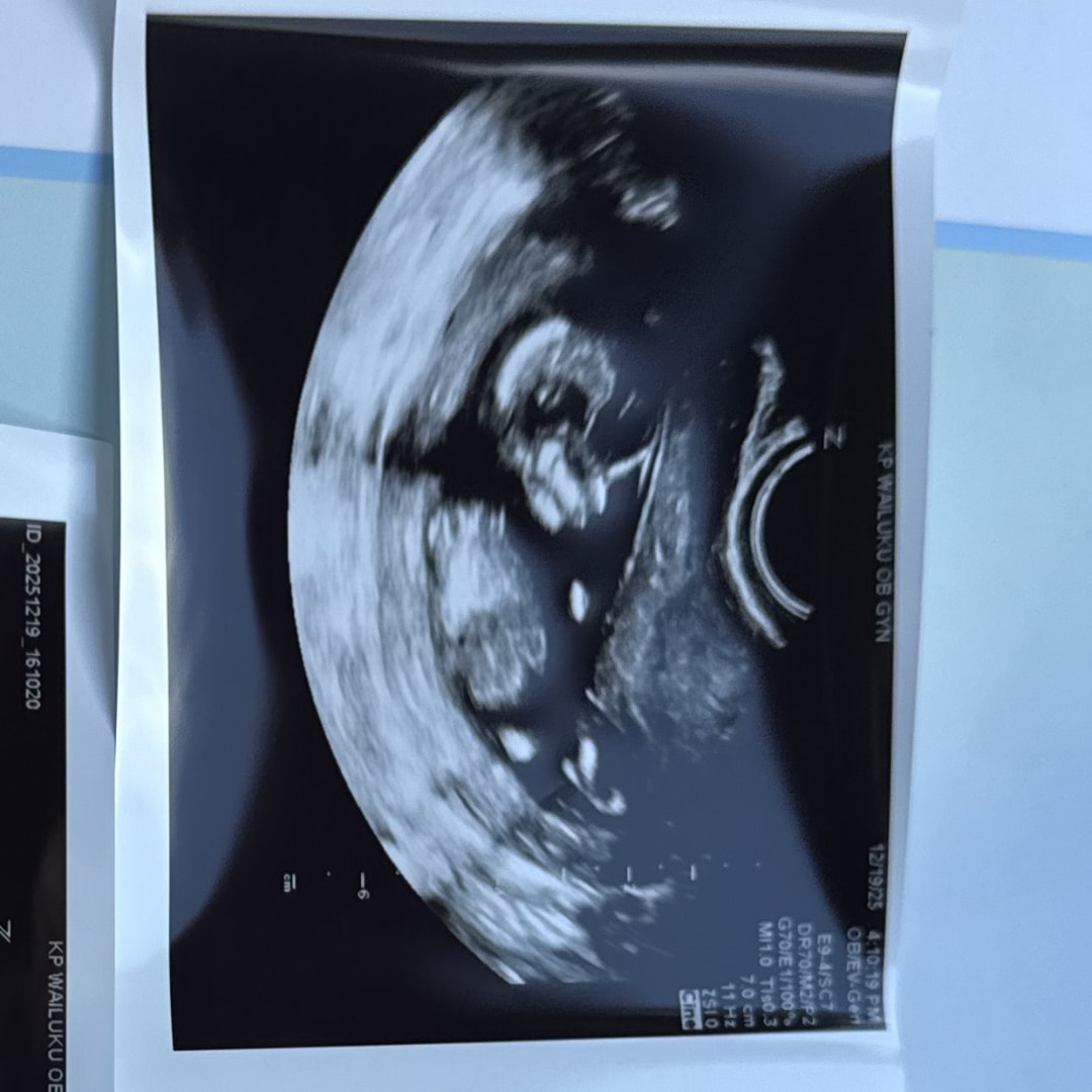 Photo shared by Elisa for their Babylist baby registry.