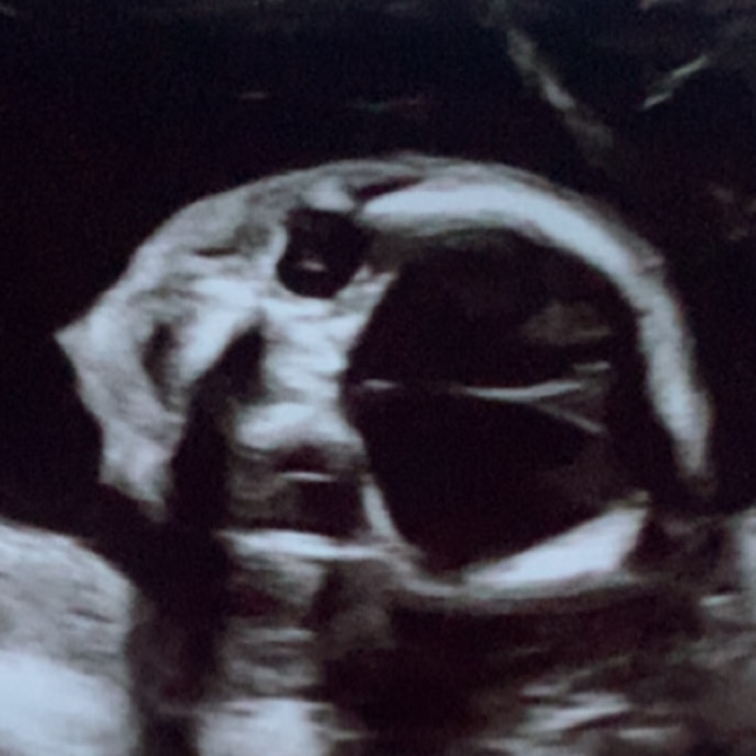 Photo shared by Emily for their Babylist baby registry.