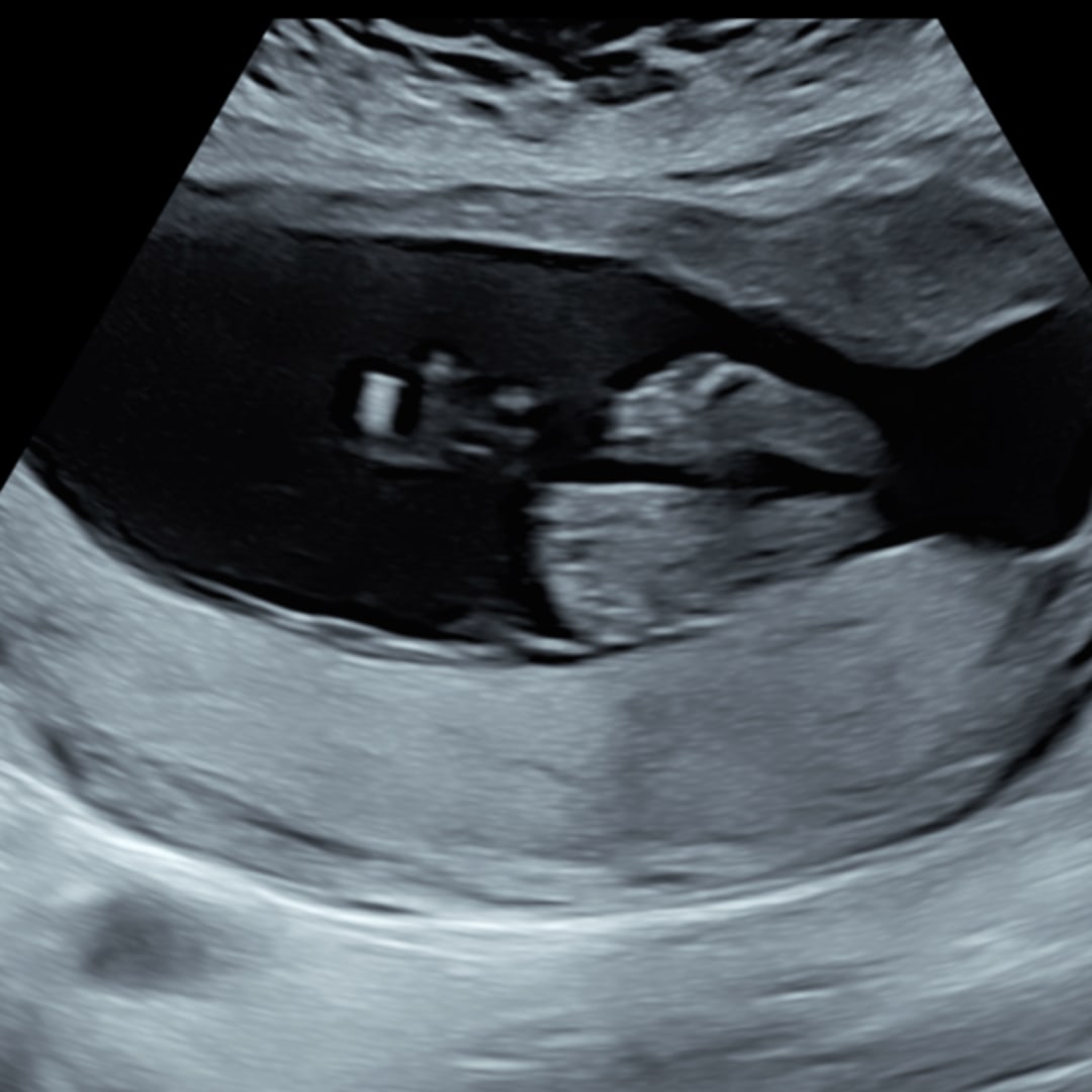 Photo shared by Delia for their Babylist baby registry.