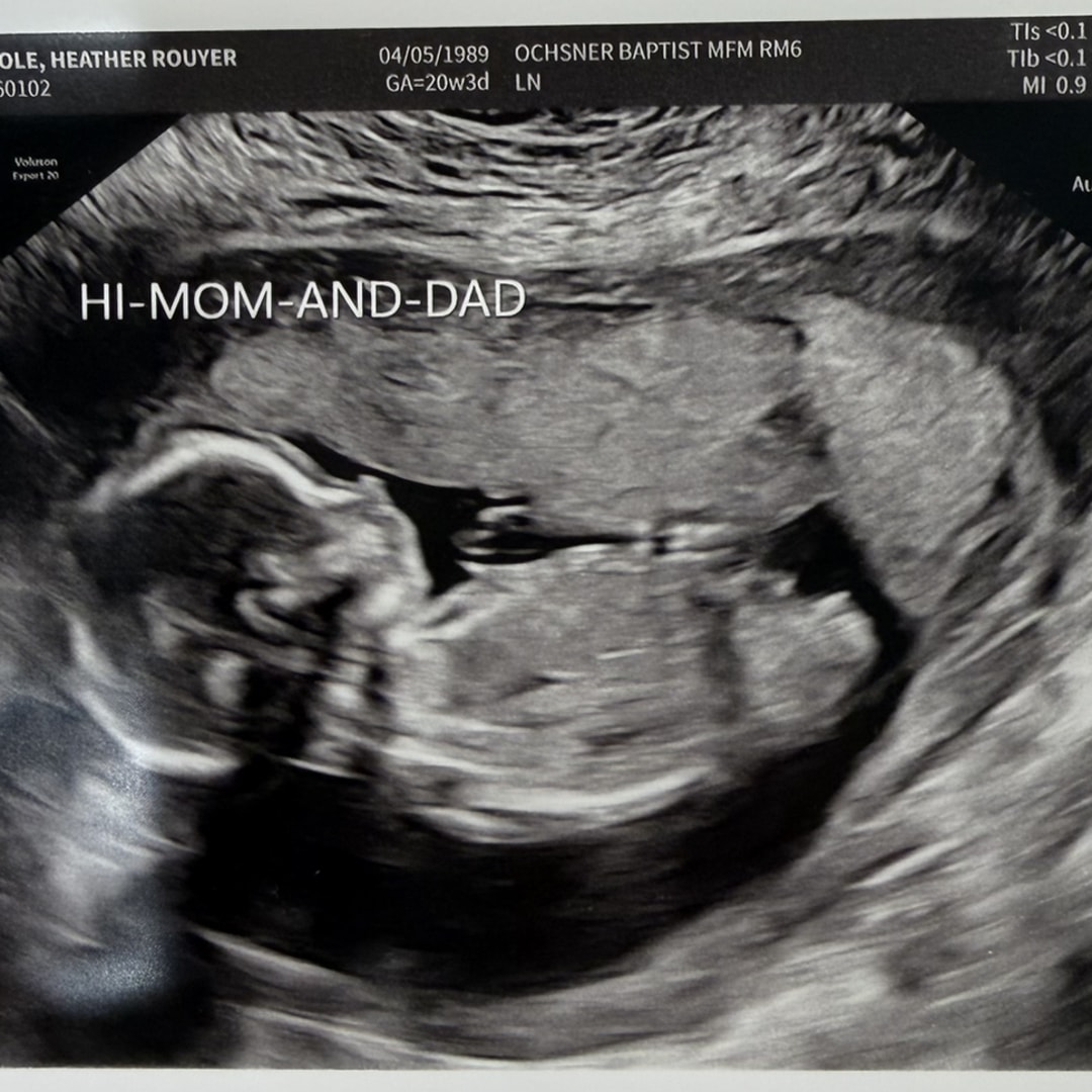 Photo shared by Heather for their Babylist baby registry.