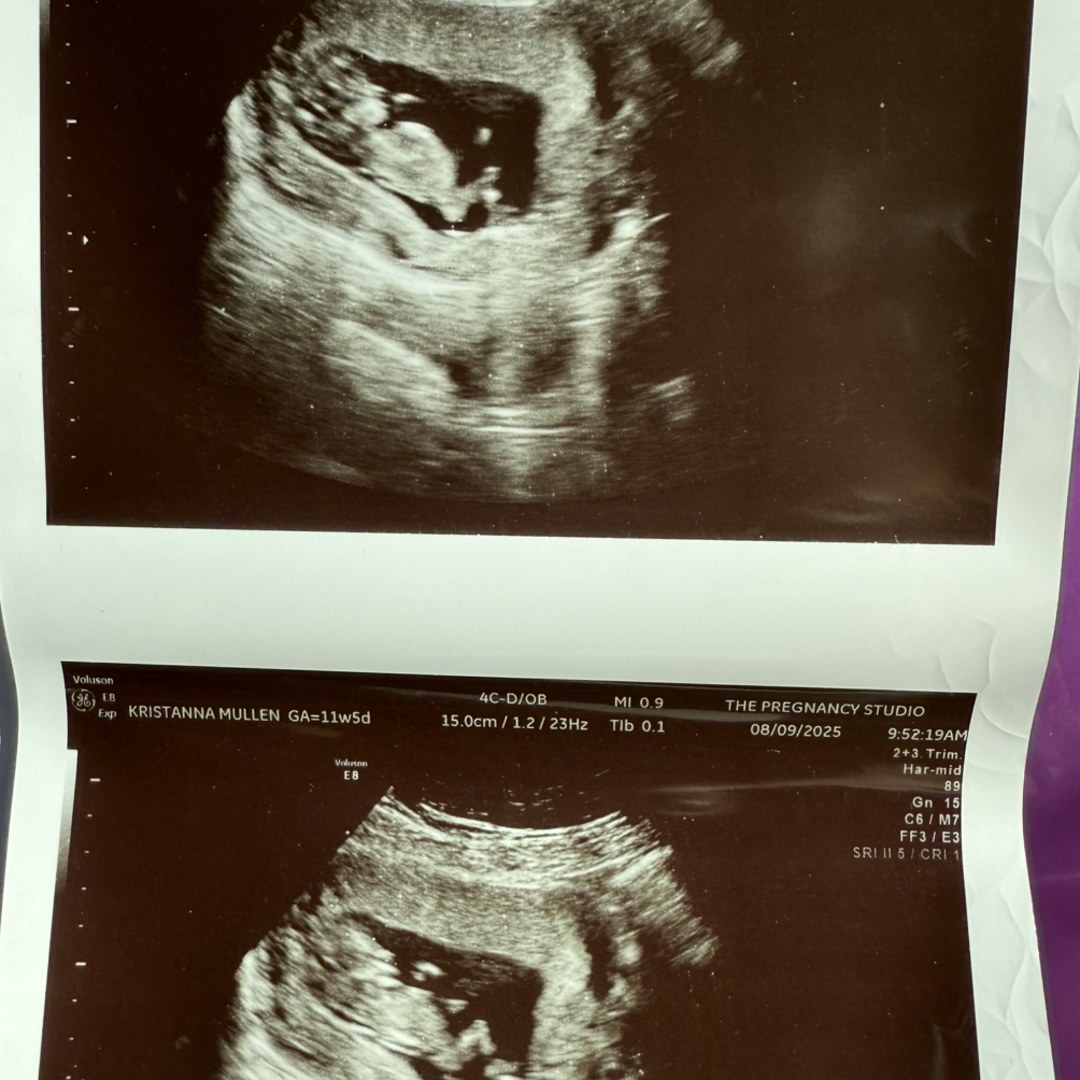 Photo shared by Kristianna for their Babylist baby registry.