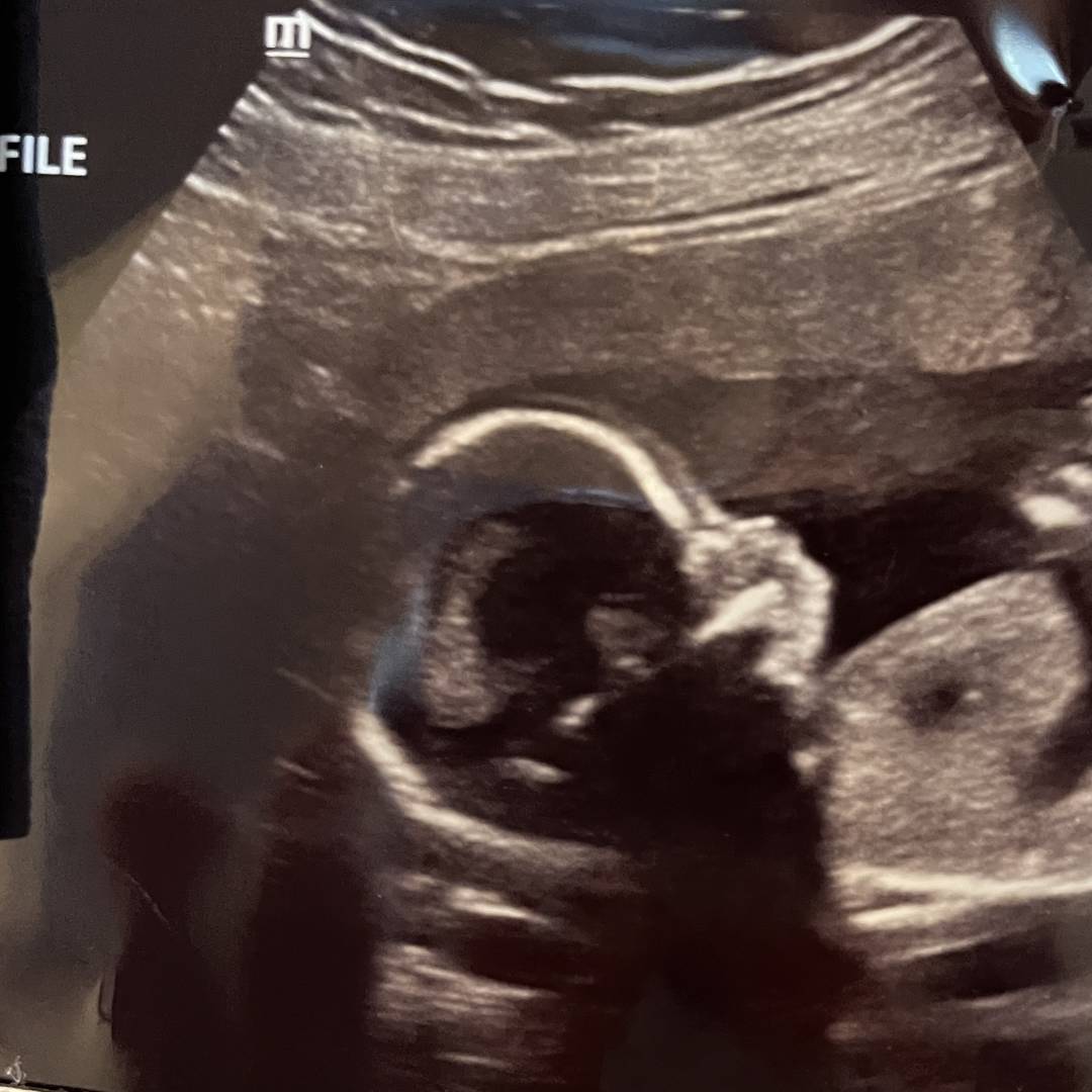 Photo shared by Cameron for their Babylist baby registry.