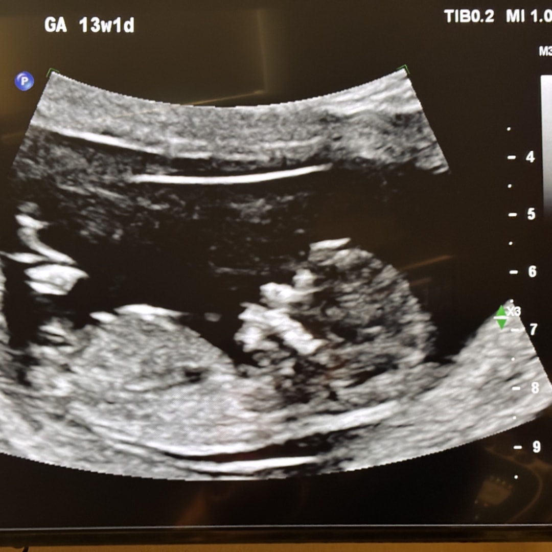 Photo shared by Michael for their Babylist baby registry.