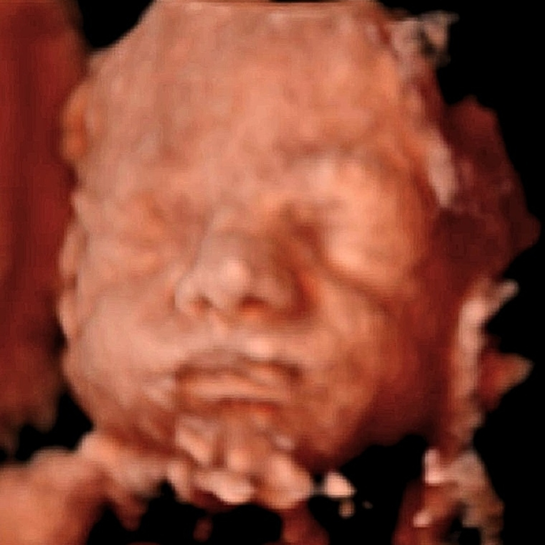 Photo shared by Patrick for their Babylist baby registry.