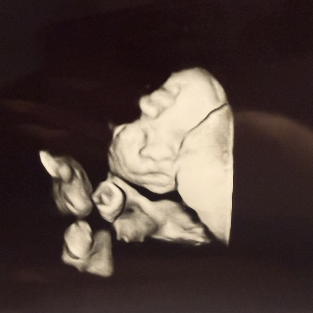 Photo shared by Ashley for their Babylist baby registry.