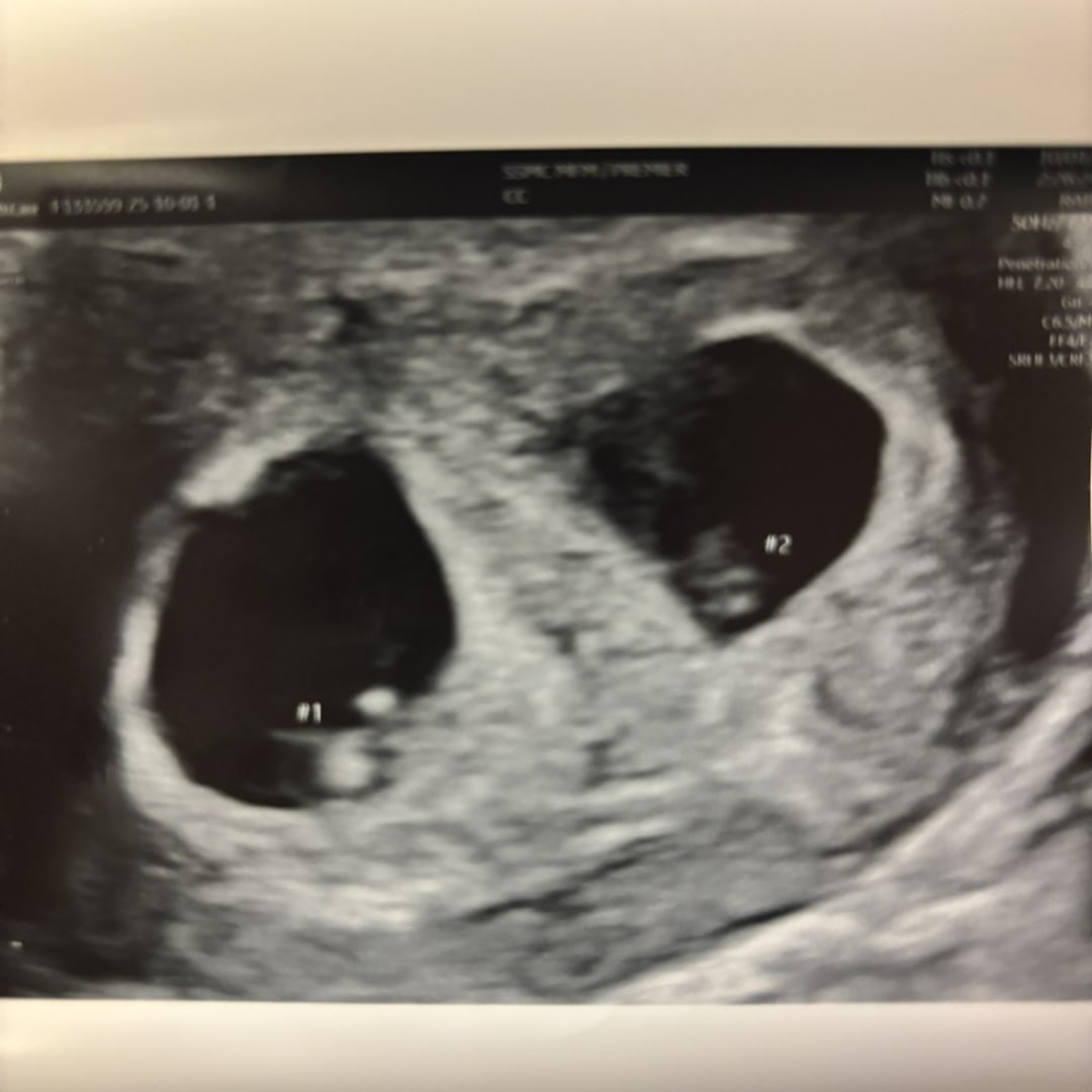 Photo shared by Carla for their Babylist baby registry.