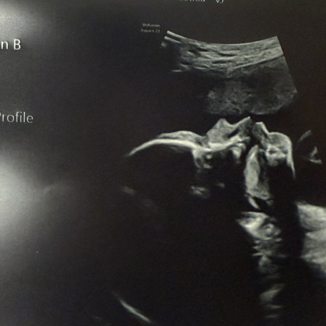 Photo shared by Christianne for their Babylist baby registry.