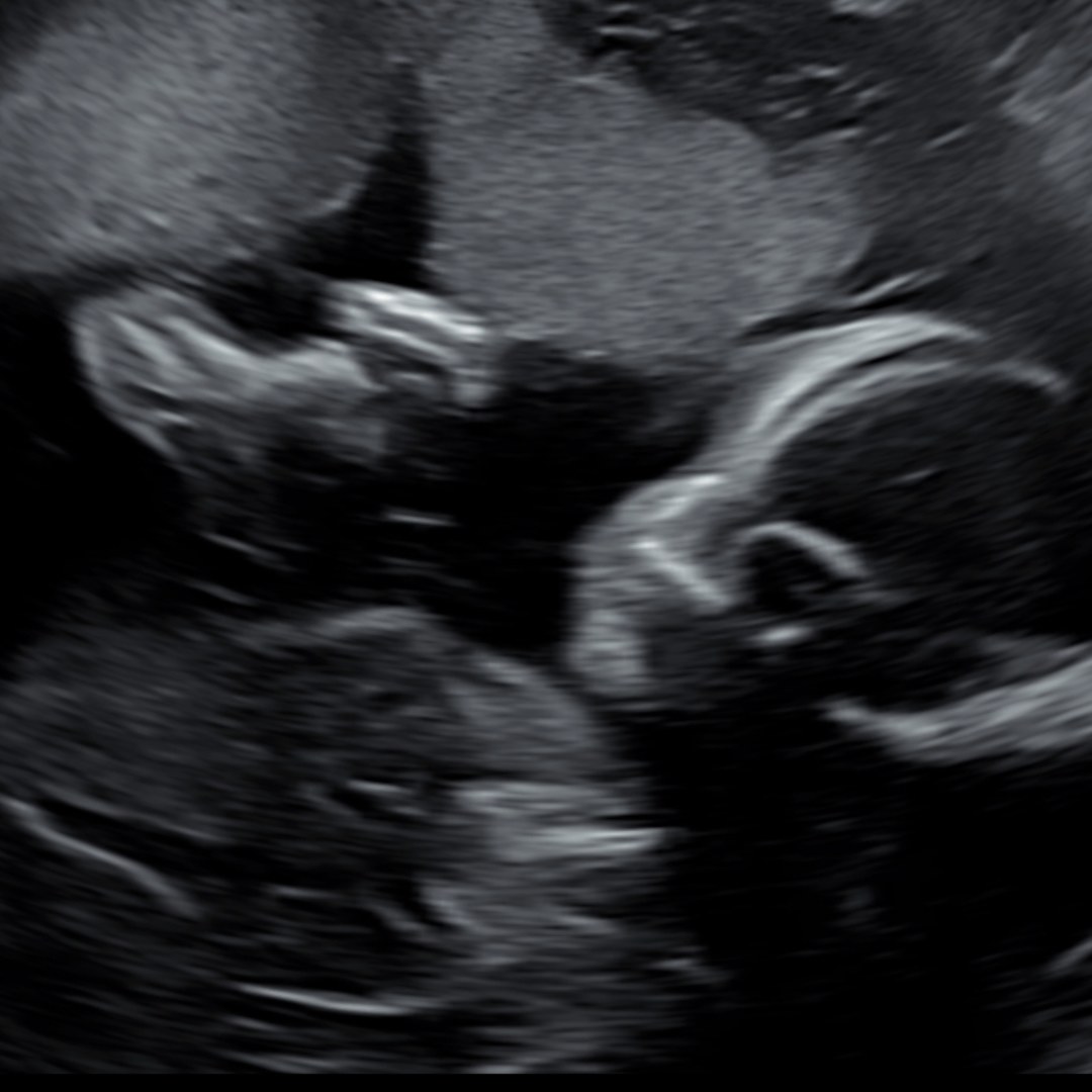 Photo shared by Emily for their Babylist baby registry.