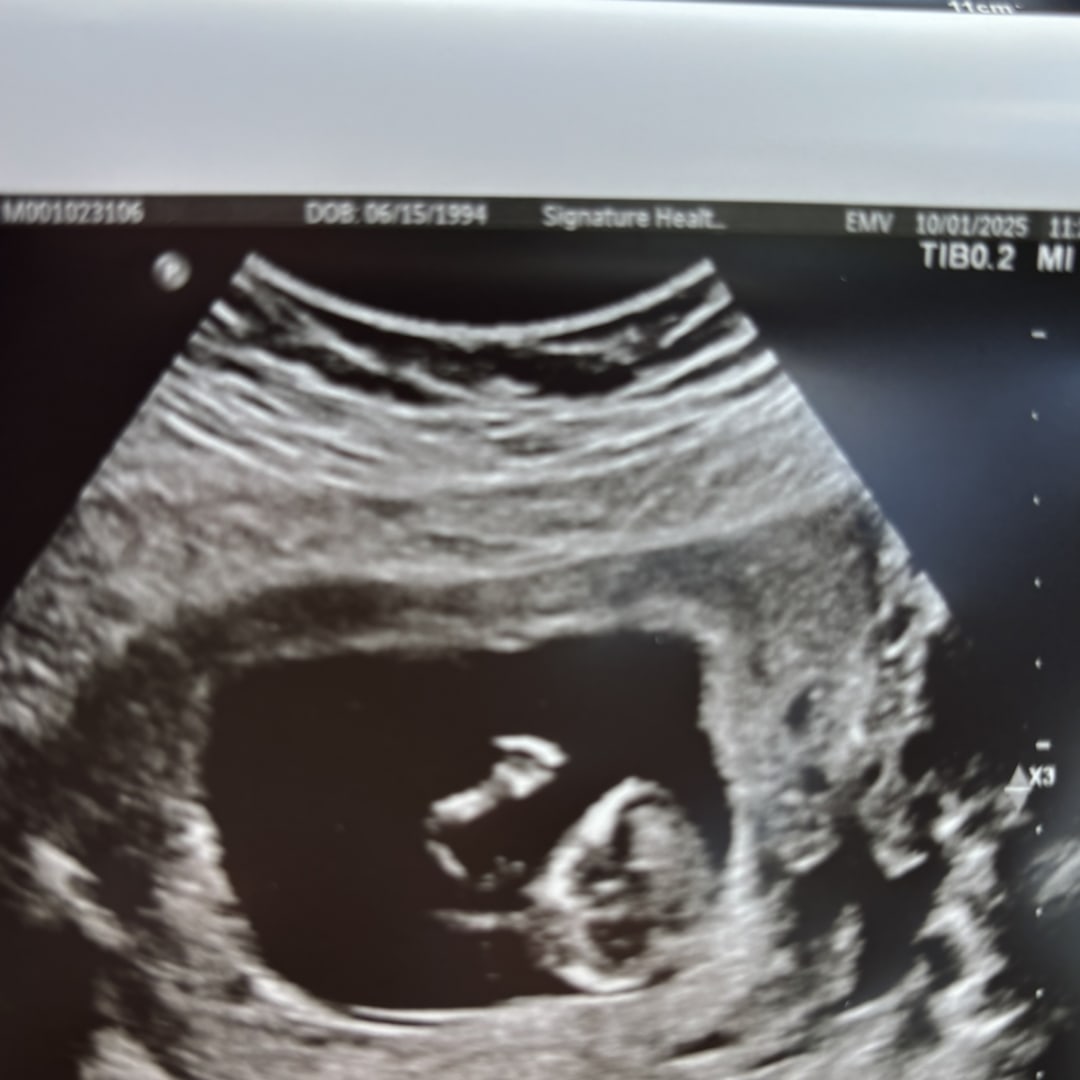 Photo shared by Katharine for their Babylist baby registry.