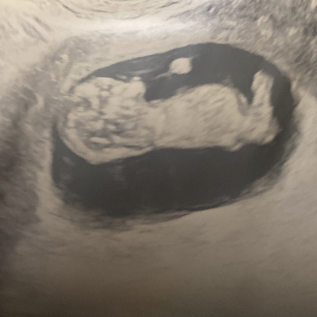 Photo shared by Alanah for their Babylist baby registry.