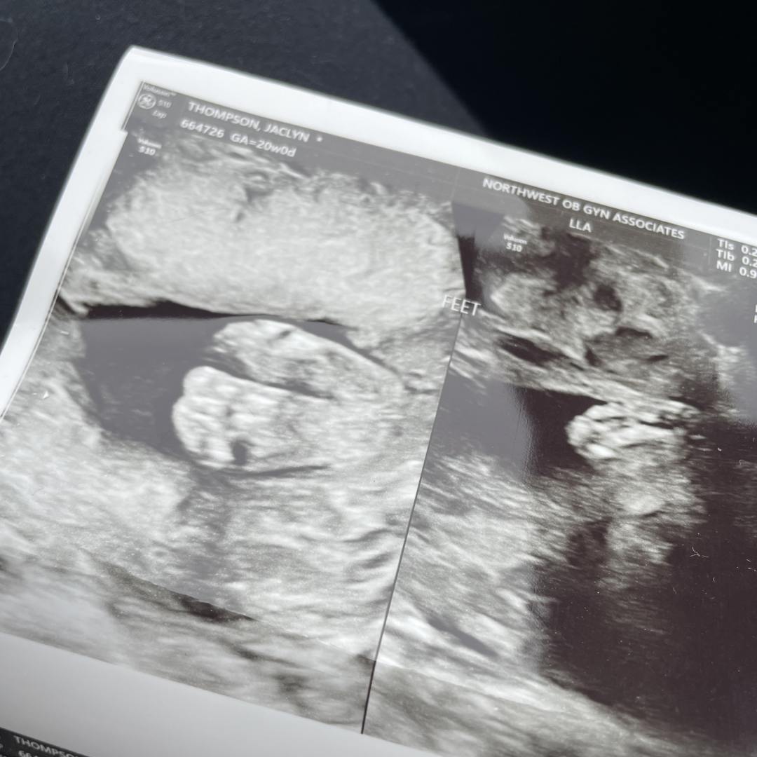 Photo shared by Jackie for their Babylist baby registry.