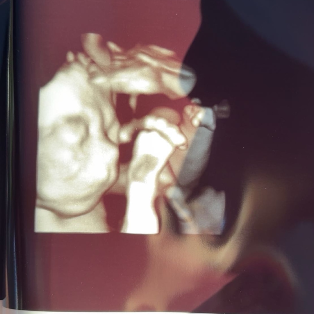 Photo shared by Skyla for their Babylist baby registry.