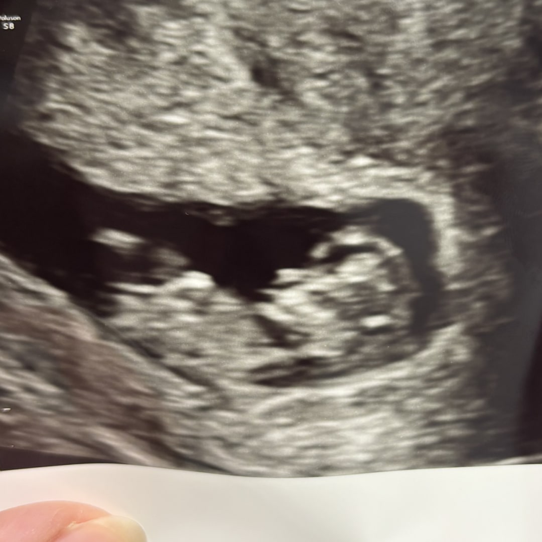 Photo shared by Nichole for their Babylist baby registry.