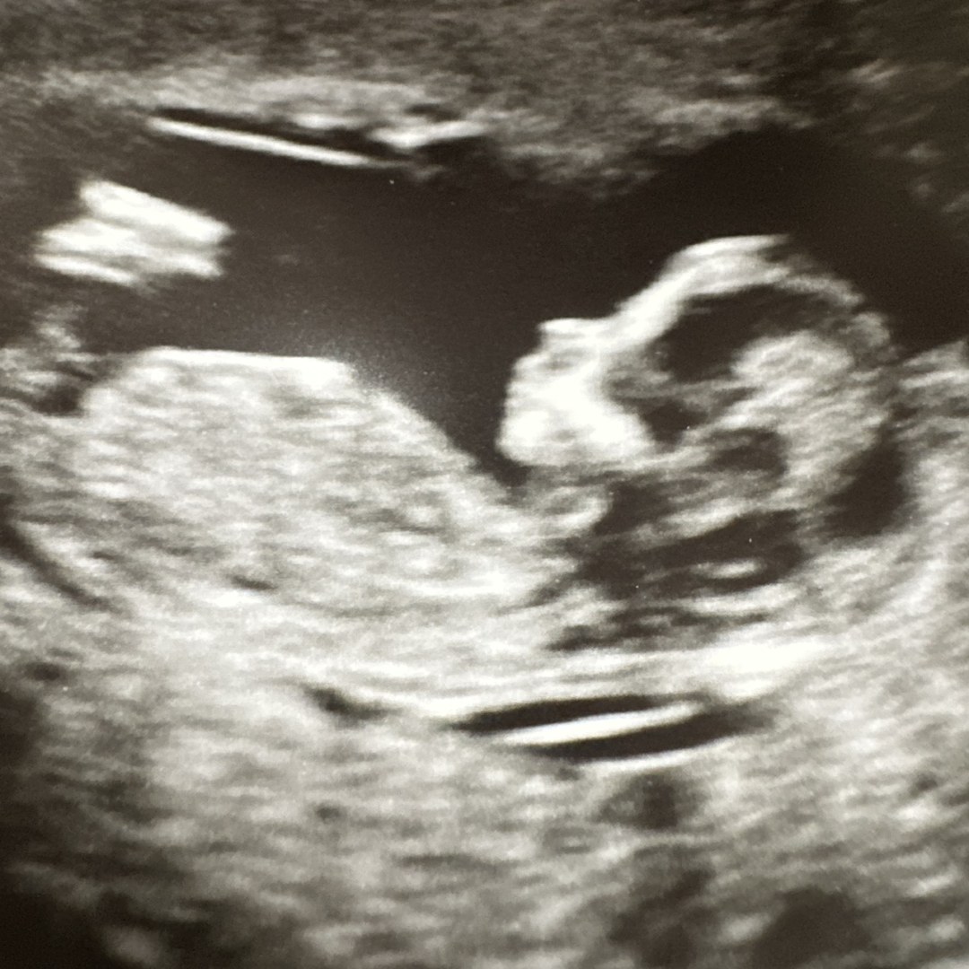 Photo shared by Jenna for their Babylist baby registry.