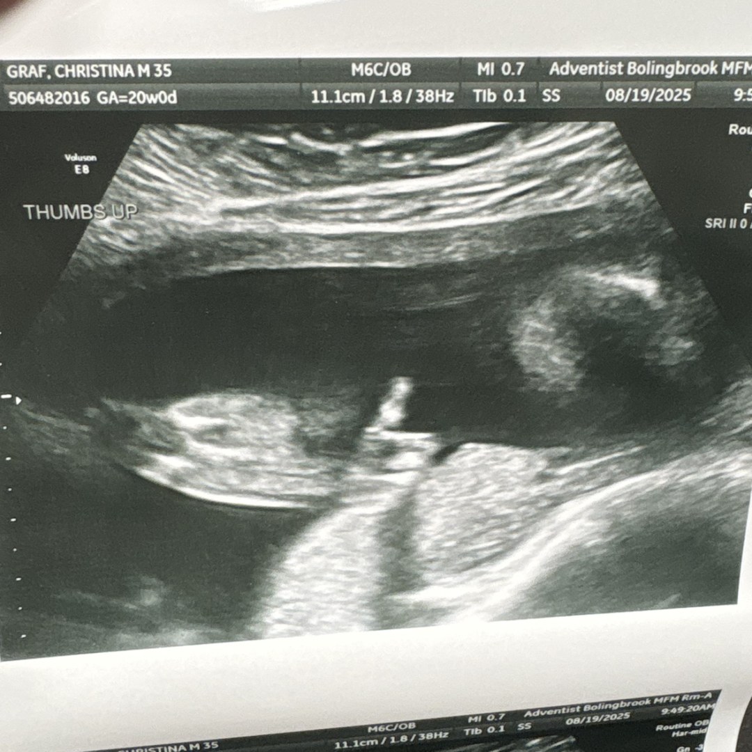 Photo shared by Chrissy for their Babylist baby registry.