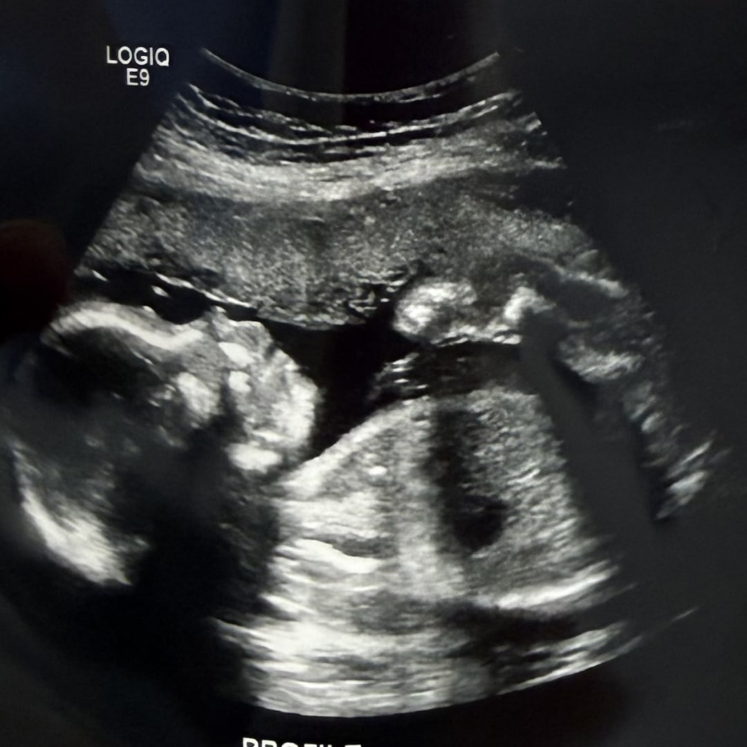 Photo shared by Allison for their Babylist baby registry.
