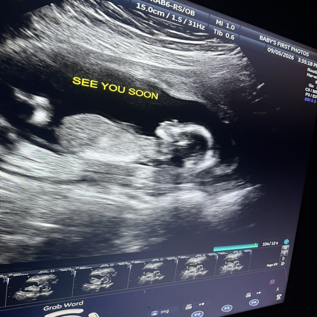 Photo shared by Allanah for their Babylist baby registry.