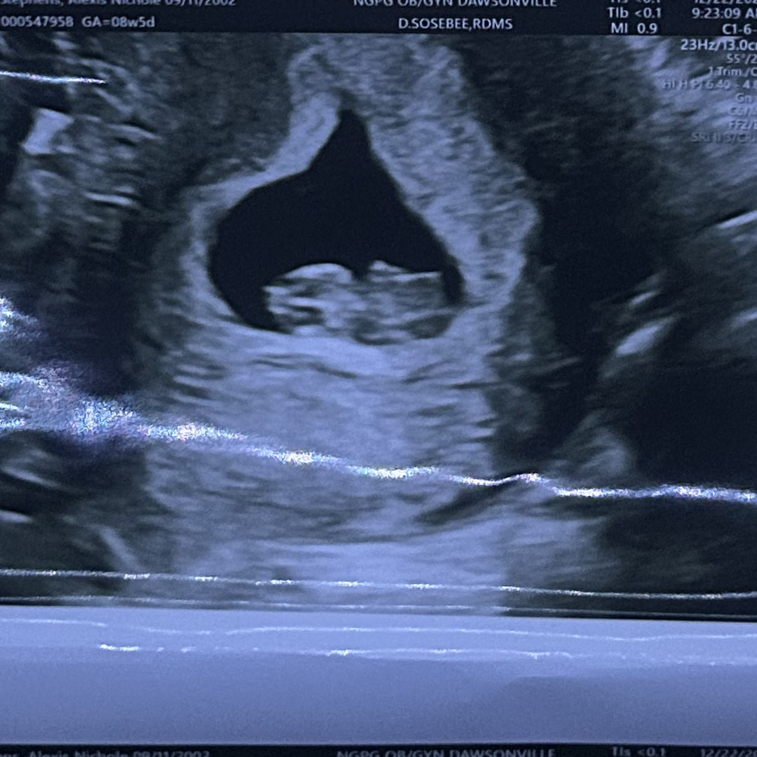 Photo shared by Lexie for their Babylist baby registry.