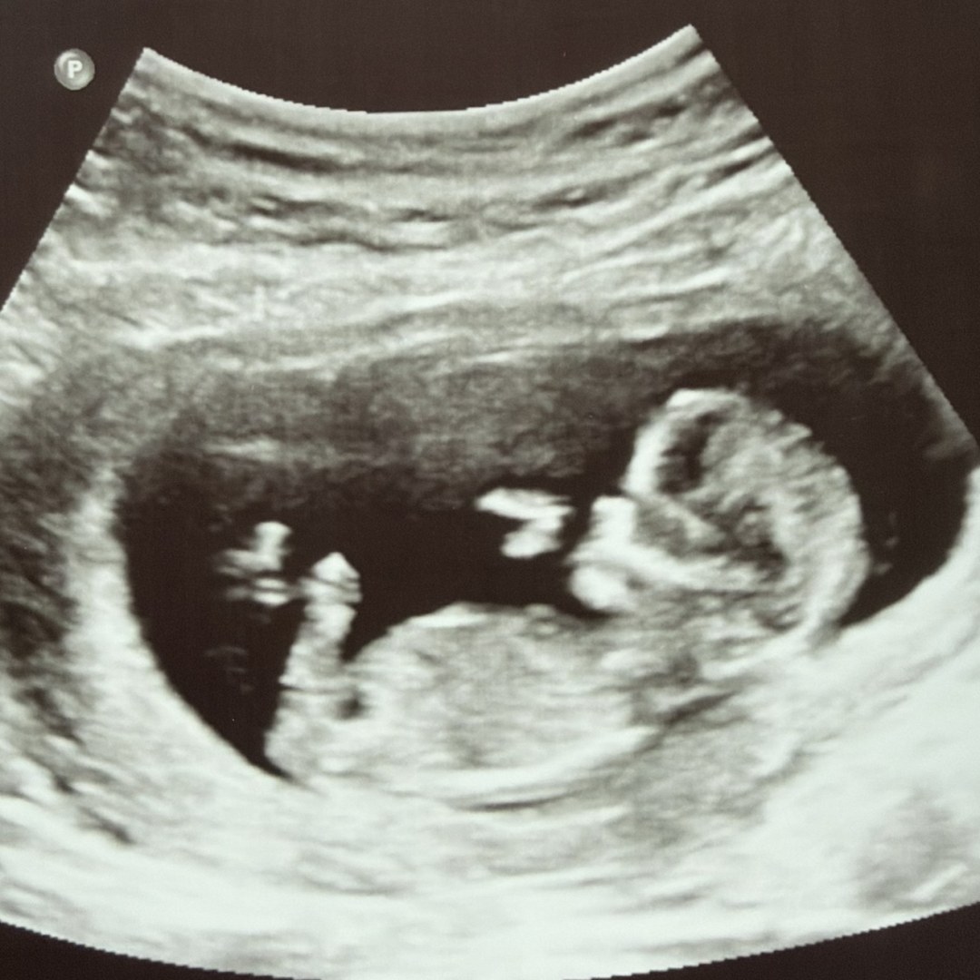 Photo shared by Aleesha for their Babylist baby registry.