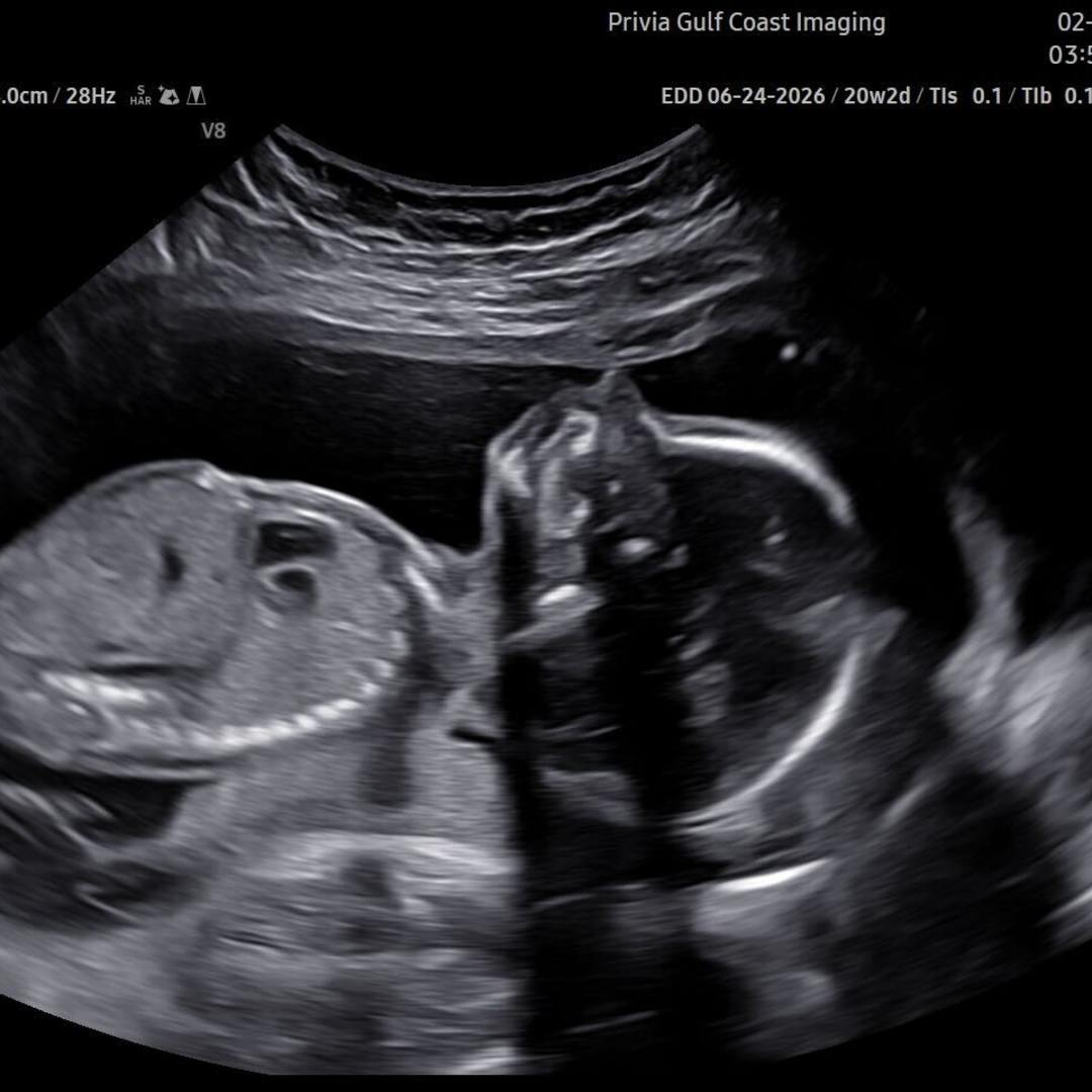 Photo shared by Emily for their Babylist baby registry.