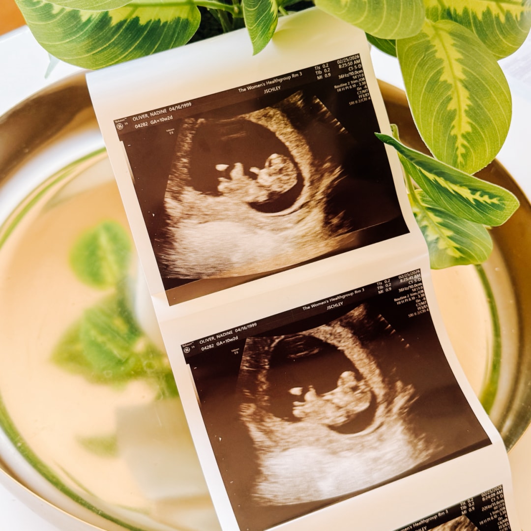 Photo shared by Nadine for their Babylist baby registry.