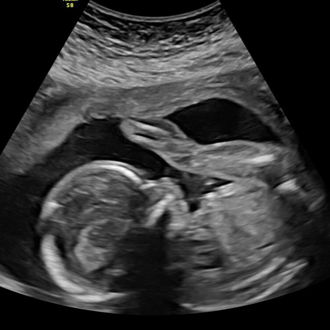 Photo shared by Rachel for their Babylist baby registry.