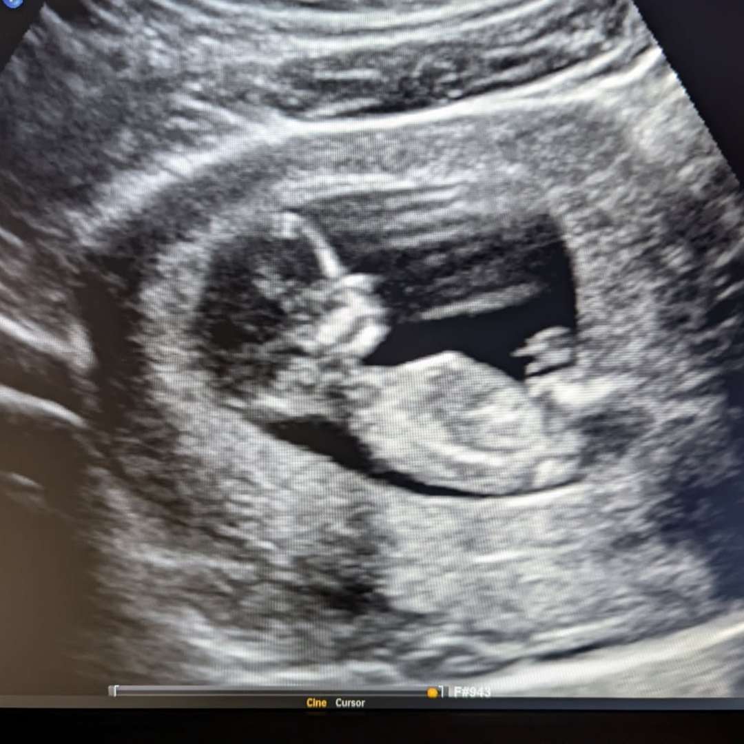 Photo shared by Marissa for their Babylist baby registry.