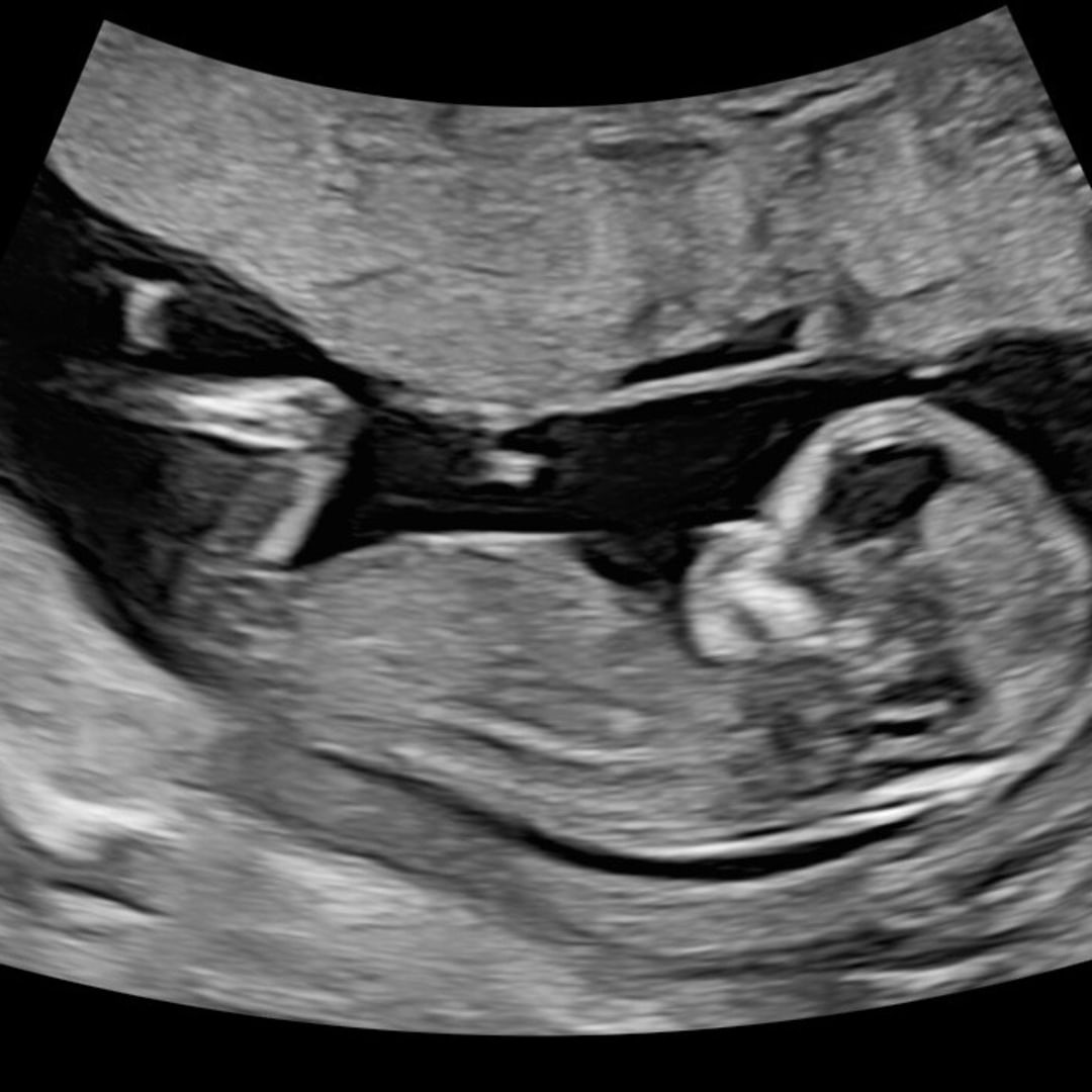 Photo shared by Makenna for their Babylist baby registry.