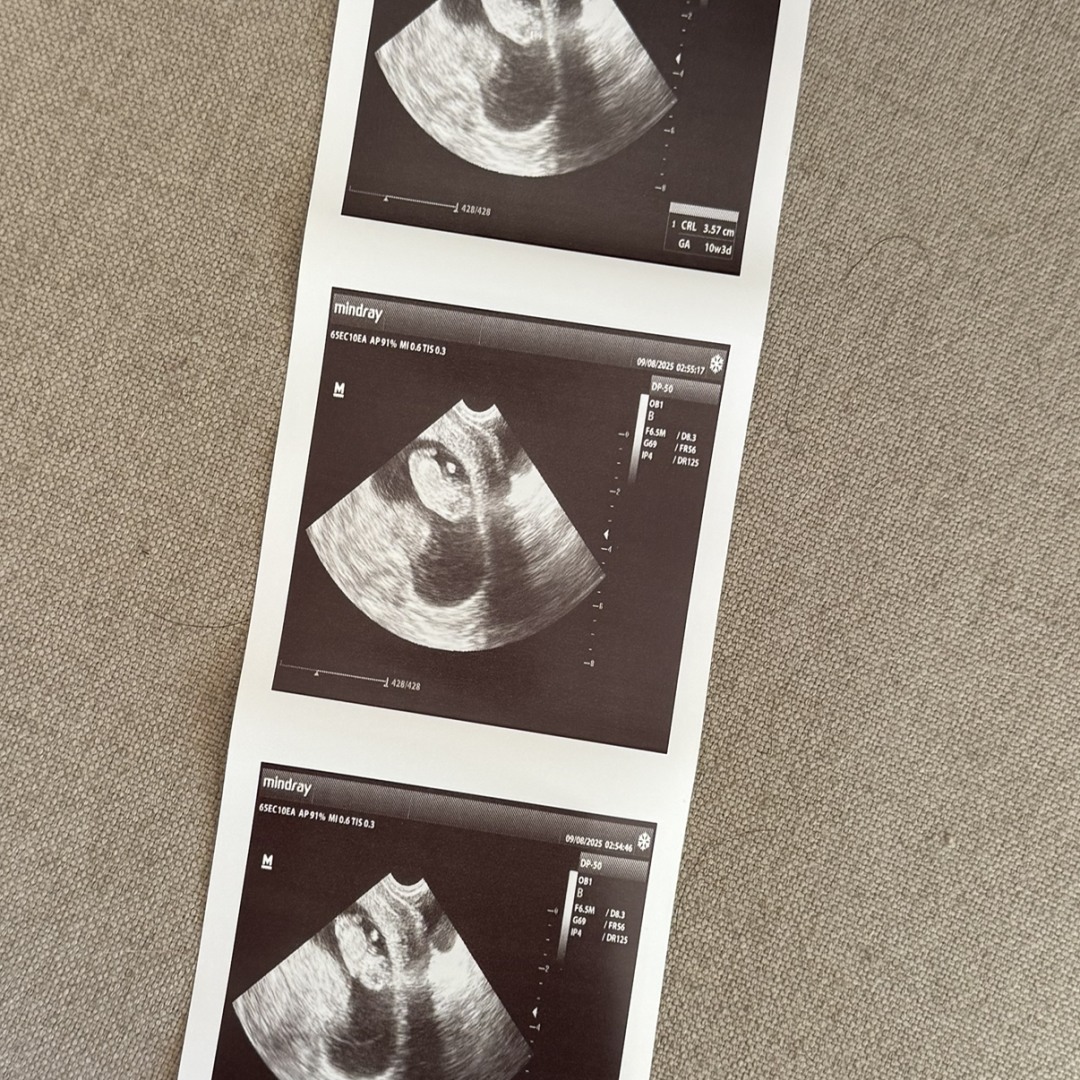 Photo shared by Sierra for their Babylist baby registry.