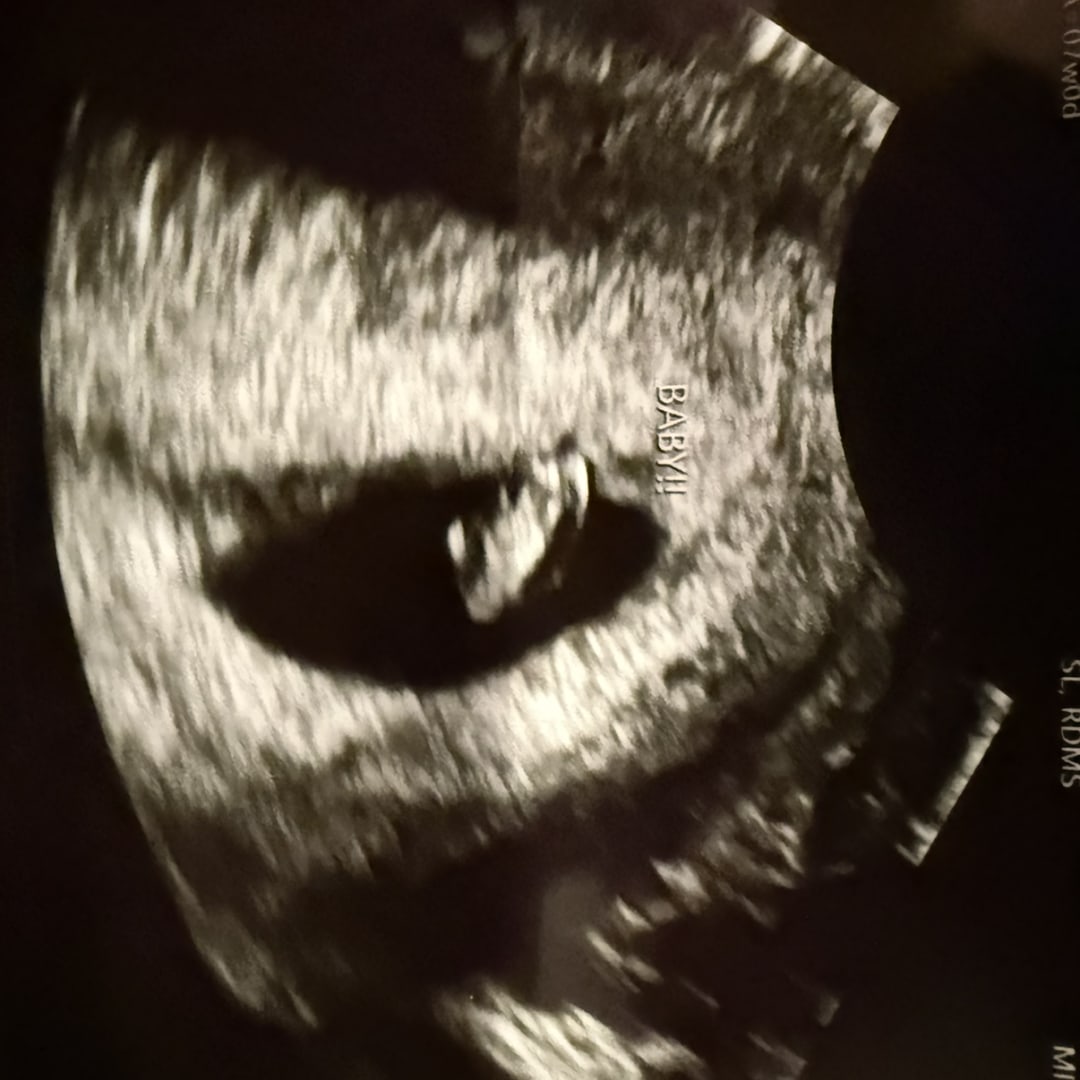 Photo shared by Breanna for their Babylist baby registry.