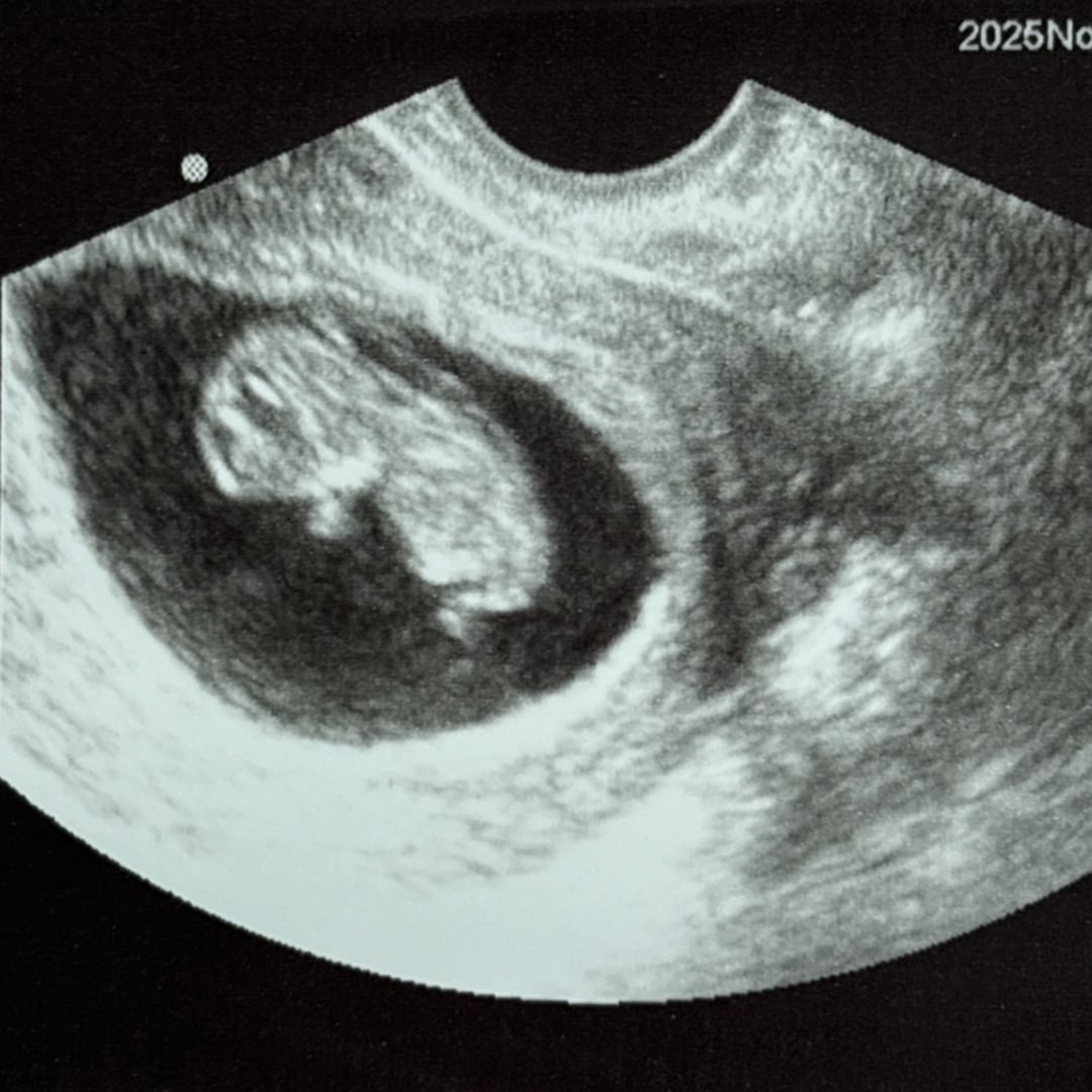 Photo shared by Jamie for their Babylist baby registry.