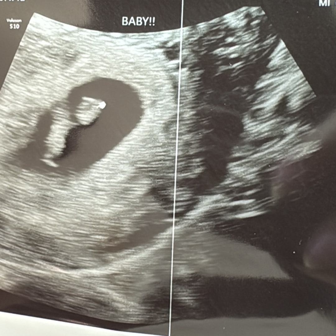 Photo shared by Raquel for their Babylist baby registry.