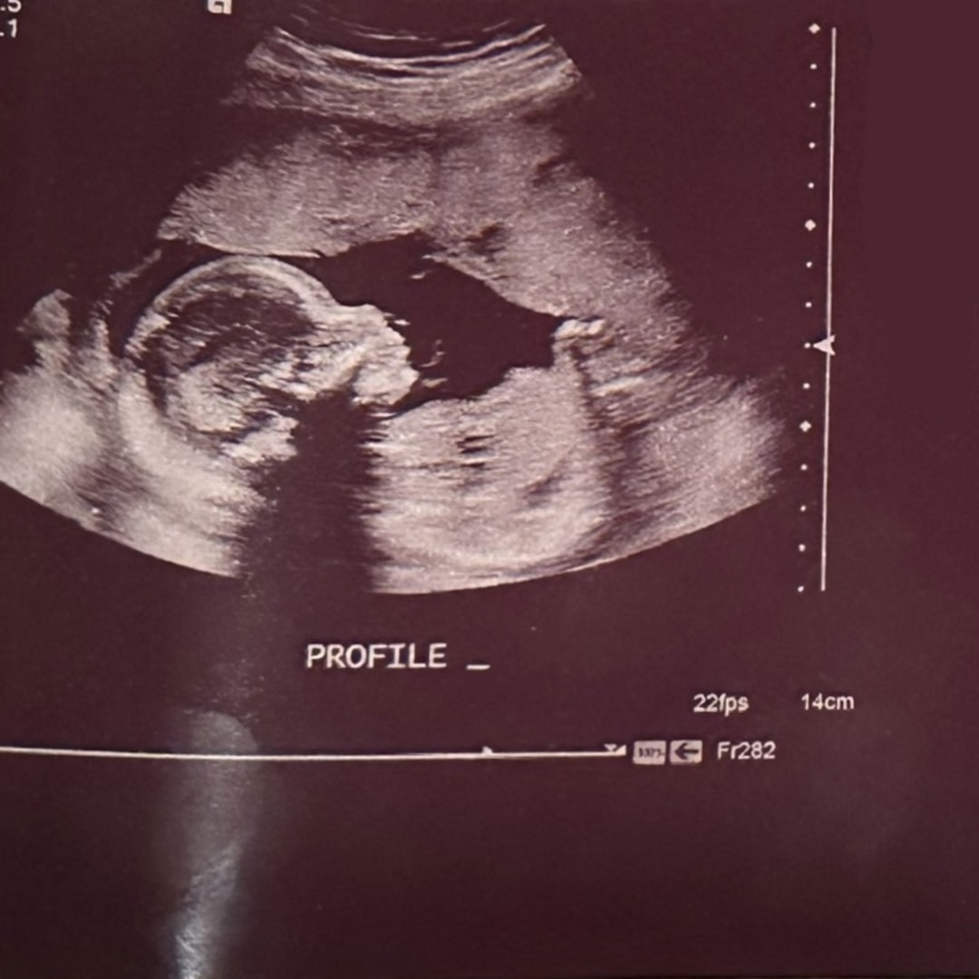 Photo shared by Denise for their Babylist baby registry.