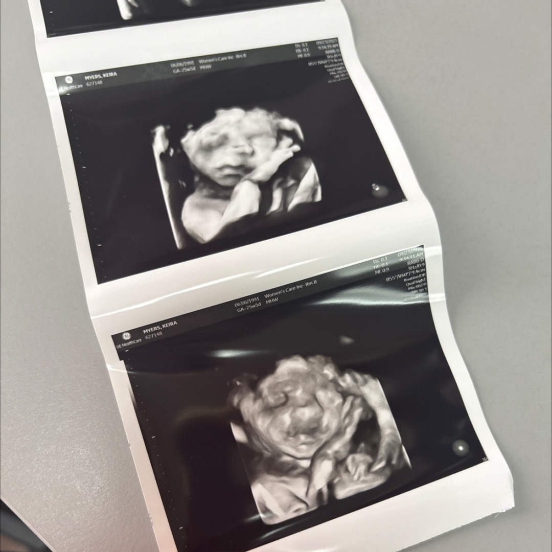 Photo shared by Keira for their Babylist baby registry.