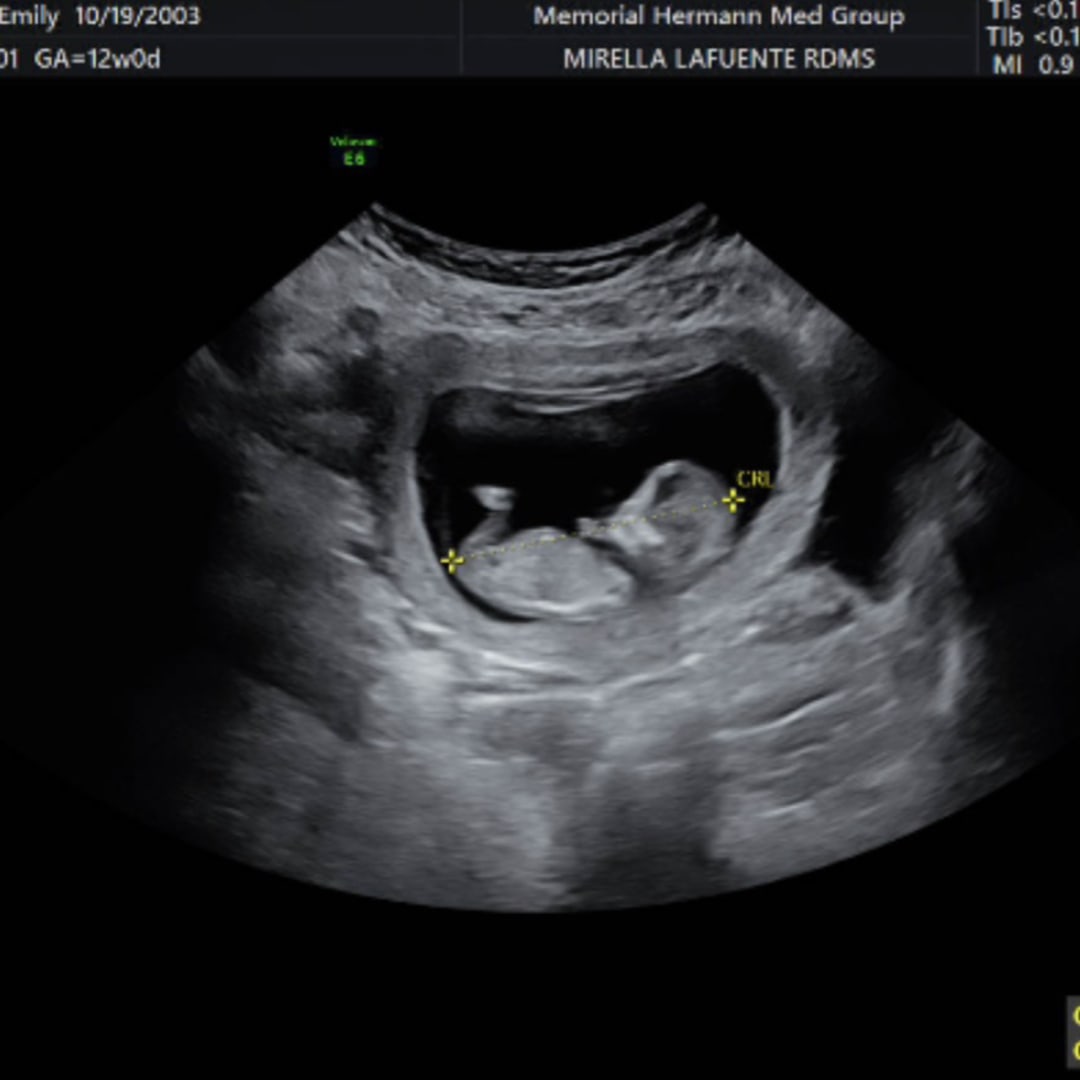 Photo shared by Emily for their Babylist baby registry.