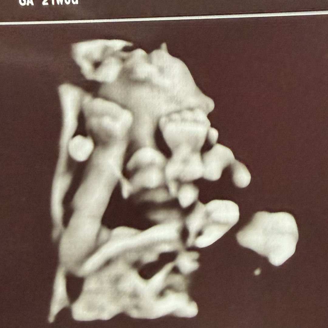 Photo shared by Macie for their Babylist baby registry.